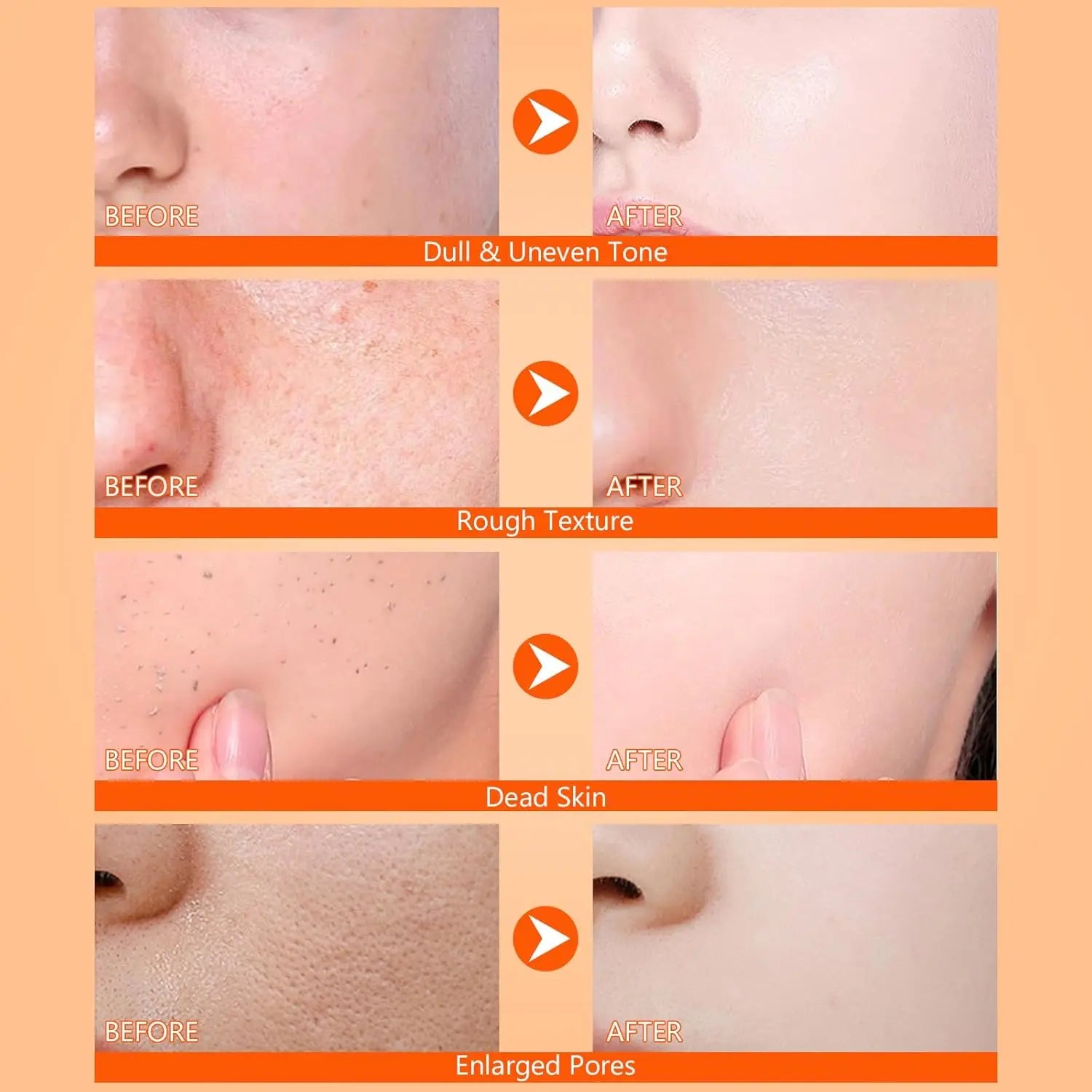 Revitalize Your Skin with Body Keratin Care Kojic Acid & Turmeric Exfoliating Spray - Nourishing & Hydrating Solution for All Skin Types!